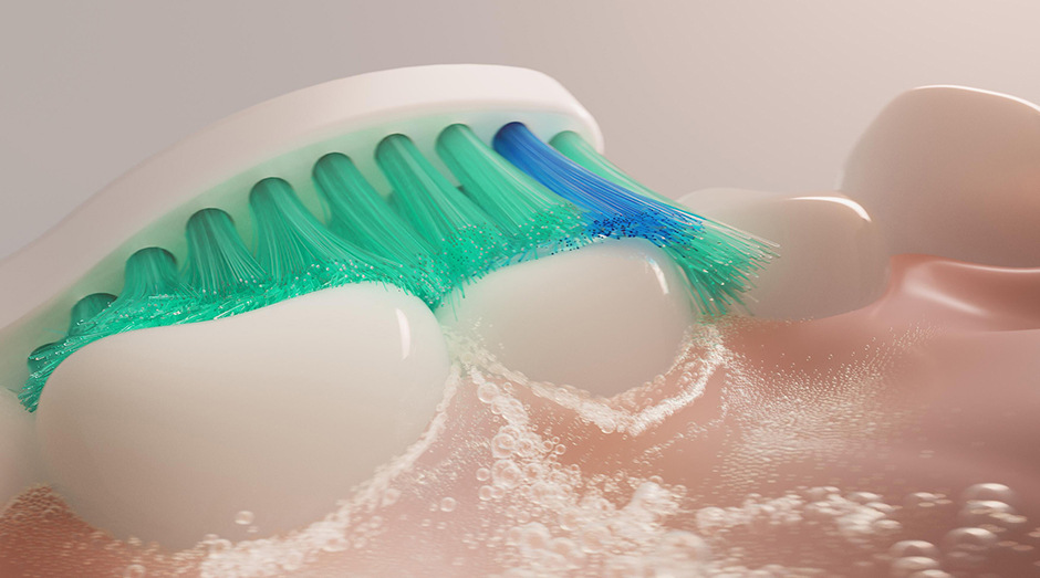 Philips HX6014/87 Sonicare ProResult