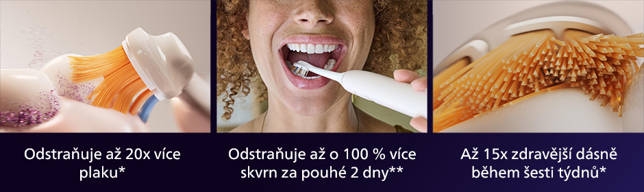 Philips HX9092/87 Sonicare Premium All-in-One