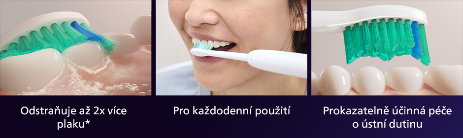 Philips HX6014/87 Sonicare ProResult