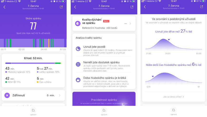 Xiaomi Mi Band 6