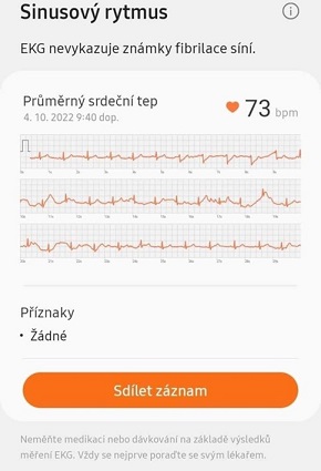 Jak dopadlo měsíční testování hodinek Samsung Galaxy Watch5 a Galaxy Watch5 Pro? Pojďte to s námi zjistit! ekg