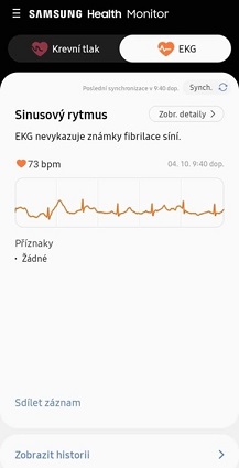 Jak dopadlo měsíční testování hodinek Samsung Galaxy Watch5 a Galaxy Watch5 Pro? Pojďte to s námi zjistit! ekg 2